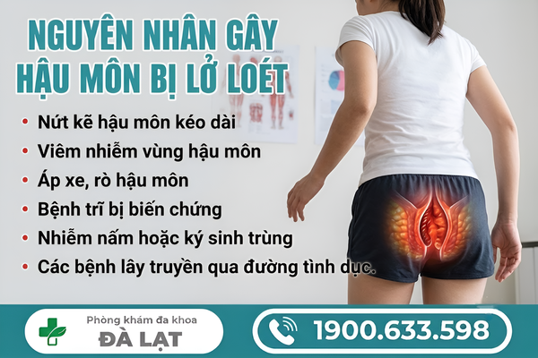 Hình ảnh minh họa